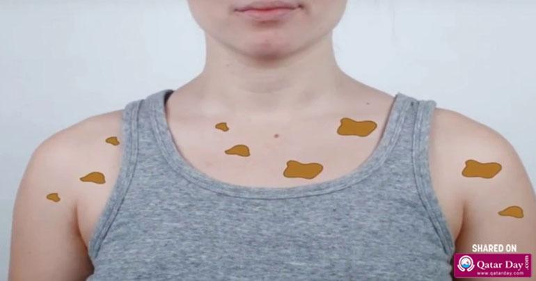 Know what happens if you do not shower for two days