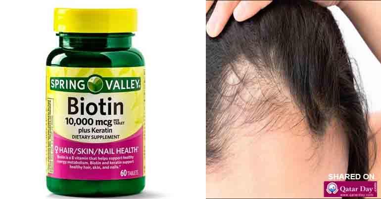 Biotin and Hair Loss