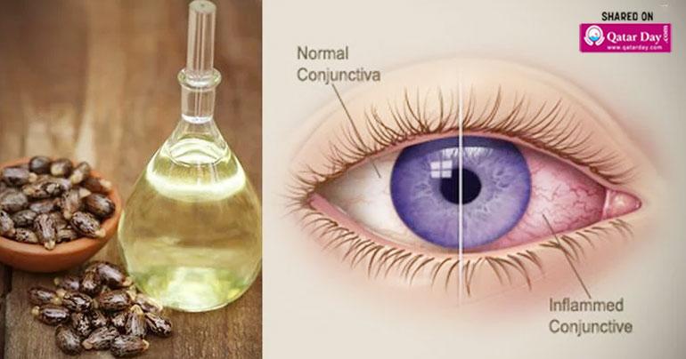 Wonderful Benefits Of Castor Oil For Your Eyes