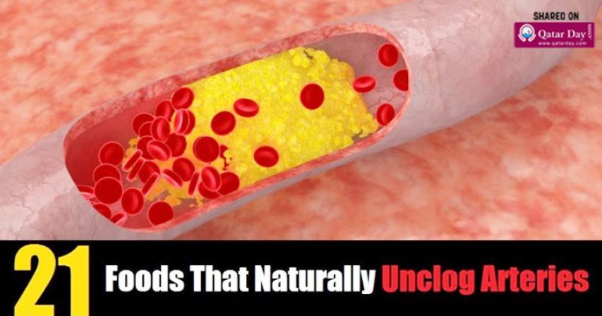 Consume These 21 Foods And You Will Naturally Unclog Arteries
