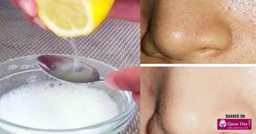 Just by Using 2 Ingredients Your Pores Will Disappear Forever and Your Face Will Be Cleaner Than Ever!
