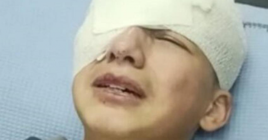 Fourteen-year-old Palestinian child loses eye after Israeli soldier 'aims and shoots' at him