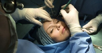 3 Concerns Which Might Haunt You Before Going for Plastic Surgery
