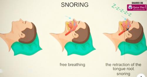 How To Stop Snoring Naturally: 5 Effective Ways That Work
