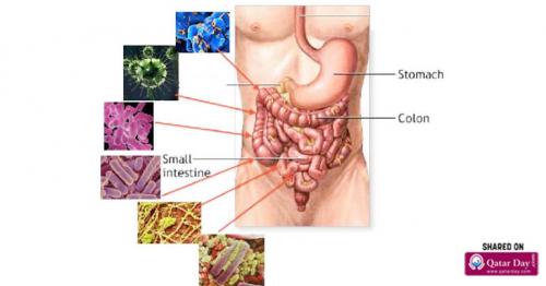5 Causes And 5 Treatments Of Irritable Bowel Syndrome
