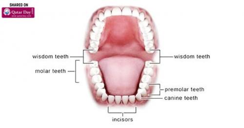 A Close Look At Wisdom Teeth