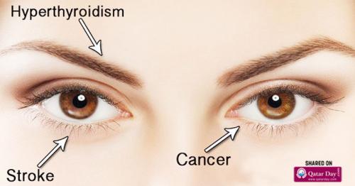 14 Things Your Eyes are Trying to Tell You About Your Health
