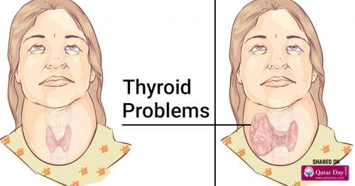 11 Foods That Significantly Improve Your Thyroid Health and Help to Treat Thyroid Problems
