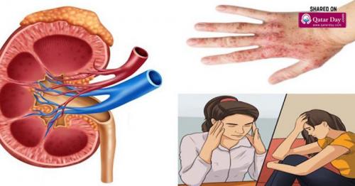 If Your Kidneys Are In Danger, These Are The 6 Signs You Shouldn’t Ignore
