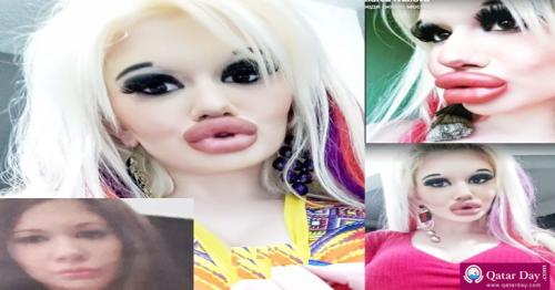 Bulgarian woman undergoes dramatic transformation after having 15 operations to look like Barbie doll
