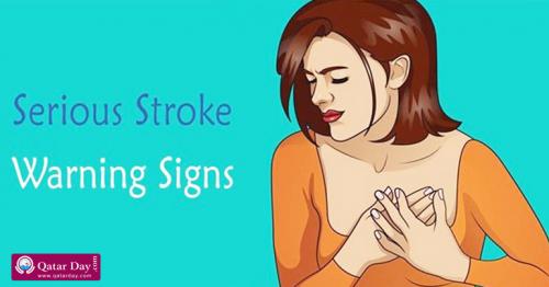  Stroke Warning Signs You Should Know Before It’s Too Late
