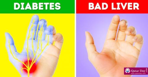 15 Things Your Hands Reveal About Your Health
