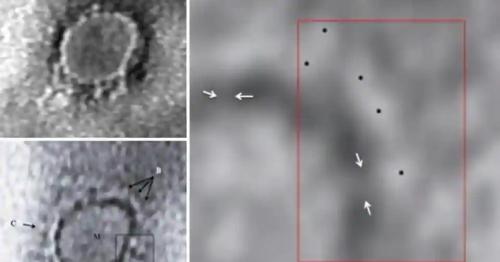 First Images from India of Virus Causing Covid-19 Captured by Scientists