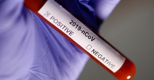 Recovered coronavirus patients are testing positive again