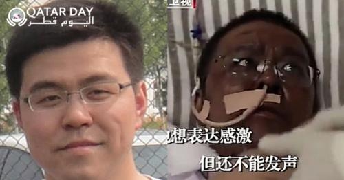Wuhan doctor whose skin turned dark due to Covid-19 treatment, dies 