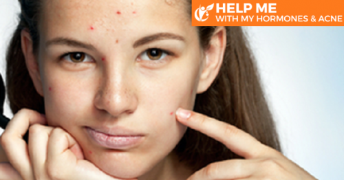 Hormonal Acne Treatment and its Characteristics