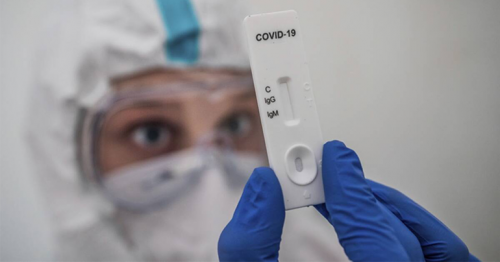 Oxford scientists develop five-minute COVID-19 antigen test