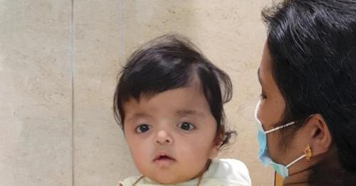 Sidra Medicine performs life-saving surgery on baby girl with Apert Syndrome